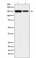 Anti-KDM4B / JMJD2B Rabbit Monoclonal Antibody