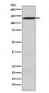 Anti-USP28 Rabbit Monoclonal Antibody