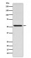 Anti-THRA Rabbit Monoclonal Antibody