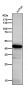 Anti-ADA Rabbit Monoclonal Antibody