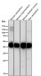 Anti-ADA Rabbit Monoclonal Antibody