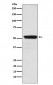 Anti-ACM2 Rabbit Monoclonal Antibody