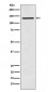 Anti-CARD11 Rabbit Monoclonal Antibody