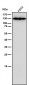 Anti-CARD11 Rabbit Monoclonal Antibody