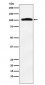 Anti-Thyroid Peroxidase Rabbit Monoclonal Antibody