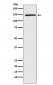 Anti-PLCG2 Rabbit Monoclonal Antibody