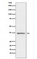 Anti-STC1 Rabbit Monoclonal Antibody