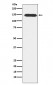 Anti-PLCB3 Rabbit Monoclonal Antibody