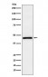 Anti-TMEFF2 Rabbit Monoclonal Antibody