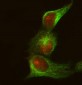 Anti-CRKII Rabbit Monoclonal Antibody