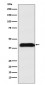 Anti-M6PR Rabbit Monoclonal Antibody