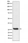 Anti-Hippocalcin Rabbit Monoclonal Antibody