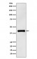 Anti-IL12 p40 Rabbit Monoclonal Antibody