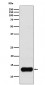 Anti-Cystatin A Rabbit Monoclonal Antibody