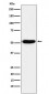 Anti-IRF4 Rabbit Monoclonal Antibody