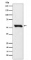 Anti-DLDH Rabbit Monoclonal Antibody