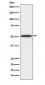 Anti-Inhibin beta B Rabbit Monoclonal Antibody