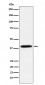 Anti-Phospho-IKB alpha (S36) Rabbit Monoclonal Antibody