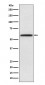 Anti-LCAT Rabbit Monoclonal Antibody