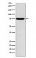 Anti-GAA Rabbit Monoclonal Antibody