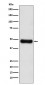 Anti-ADK Rabbit Monoclonal Antibody