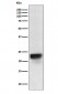 Anti-FSH beta Rabbit Monoclonal Antibody