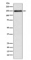 Anti-COL11A1 Rabbit Monoclonal Antibody