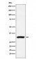 Anti-CBR1 Rabbit Monoclonal Antibody