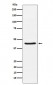 Anti-HSD3B1 Rabbit Monoclonal Antibody