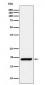 Anti-CIRBP Rabbit Monoclonal Antibody