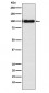 Anti-Desmocollin-3 Rabbit Monoclonal Antibody