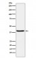 Anti-SerpinB3 Rabbit Monoclonal Antibody