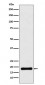 Anti-UBE2B Rabbit Monoclonal Antibody