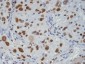 Anti-TDP43 Rabbit Monoclonal Antibody