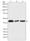 Anti-TDP43 Rabbit Monoclonal Antibody