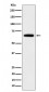 Anti-IGF2BP2 Rabbit Monoclonal Antibody