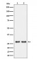 Anti-UPP1 Rabbit Monoclonal Antibody