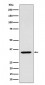 Anti-ARPC2 Rabbit Monoclonal Antibody