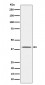 Anti-TTF1 Rabbit Monoclonal Antibody