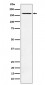 Anti-AGL Rabbit Monoclonal Antibody