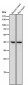 Anti-IL11RA Rabbit Monoclonal Antibody