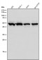 Anti-IL11RA Rabbit Monoclonal Antibody