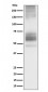 Anti-Somatostatin Receptor 1 Rabbit Monoclonal Antibody