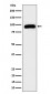 Anti-TRPV5 Rabbit Monoclonal Antibody