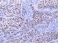 Anti-MSH2 Antibody Picoband™ (monoclonal, 6B4F7)