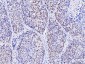 Anti-MSH2 Antibody Picoband™ (monoclonal, 6B4F7)