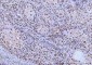 Anti-Cdk2 Antibody Picoband™ (monoclonal, 6D5B5)