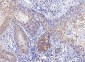 Anti-Poliovirus Receptor/PVR Antibody Picoband™ (monoclonal, 5I13D1)