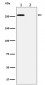 Anti-Phospho-ACC(S79) Rabbit Monoclonal Antibody