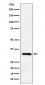 Anti-IL-33 Rabbit Monoclonal Antibody